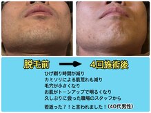 アユスパ(Ayu SPA)の雰囲気(1回でわかる脱毛効果☆早くやれば良かった!の声にうなずけます)