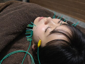 鍼灸リラクゼーションサロンLeafyの写真/【久留米・城島】美容鍼で叶える理想の小顔!むくみ一掃×血色感UPで、鏡を見るのが楽しくなるツヤ肌へ