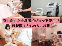 アンジェリカ(Angelica)