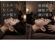 カロン(KALON)の雰囲気（美容鍼とヘッドスパの相乗効果）