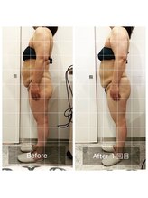 アート 熊本並木坂店(ART)/寝たまま筋トレダイエット