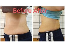 美藤鍼灸院/ダイエットコースBefore After