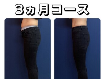 久留米スポーツ整骨院 整体院/エステ◆痩身インディバエステ