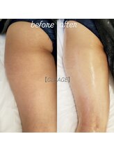 グレアージュ(GLEAGE)/四角いお尻、広がった太ももに！