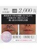 【クチコミ限定10名様！】髭フェイシャル脱毛￥5500→50％OFF以下