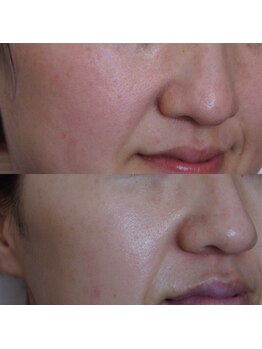 ザ シー タイムレスビューティ(THE SHE)/30代お客様症例写真