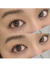 ナリ(Nari)/L3リフト