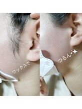 グロー アイラッシュアンドネイル(Glow)/