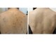 エステサロン ピリナ(pilina)の写真