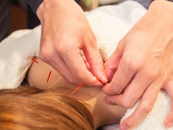 えんどう鍼灸接骨院の写真/歴30年圧倒的お客様思考の人気接骨院がHOTPEPPERBeautyに登場！慢性的な肩こり・腰痛などを根本改善◎