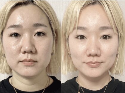 ファソ ブロウアンドアイズ(fasol)の写真