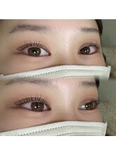 ルネラ 札幌大通(LUNELLA)/ベビーラッシュ