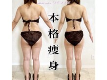 デジール(DESIR)/【実績のある本格痩身】