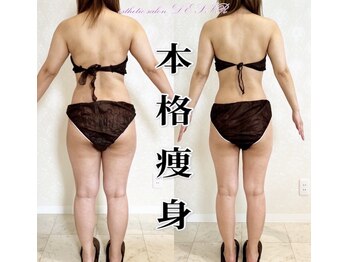 デジール(DESIR)/【実績のある本格痩身】