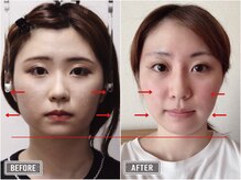 さつま骨格矯正 表参道青山院/歪み小顔矯正＋骨盤矯正