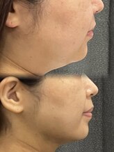 アエ メゾン(ae maison)/ここまで変わると嬉しいですね◎