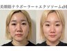 極上のエイジングケア☆テラボーラー×エクソソーム導入◎ 60500円→19800円