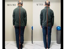 春日整体院ito/【姿勢改善ビフォーアフター】