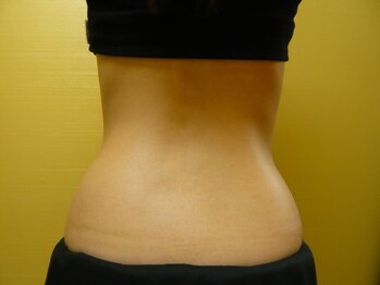 クロノス たまプラーザ店(Kronos)/キャビデトックス