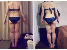 パーフェクトボディプレミアム 天王寺店(PERFECT BODY PREMIUM)/お客様　ビフォーアフター（7）