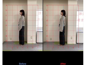 けいのき鍼灸整骨院/姿勢から身体を楽に!整体/肩こり