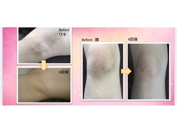 エースビューティー(Ace.Beauty)/