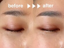 スマイル(Smile)/アイブロウWAX脱毛/眉毛パーマ