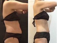 ウェリナ平和堂長久手院/小顔矯正/骨盤矯正/痩身/整体