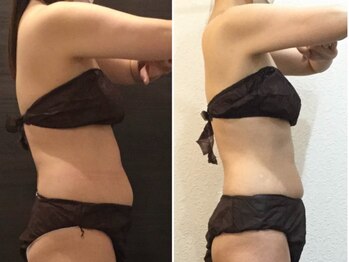 ウェリナ平和堂長久手院/小顔矯正/骨盤矯正/痩身/整体