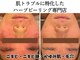 エミュ(emu)の写真