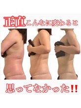 タマンサリ(Taman Sari)/むくみ撃退アーユルヴェーダ痩身