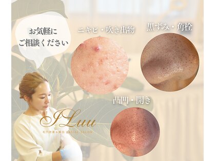 イルー(ILuu)の写真