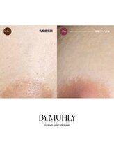 モア(more.)/おしり下黒ずみくすみ（1回）