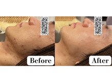 ガーオガーオ 新宿 四ツ谷(GaaoGaao)