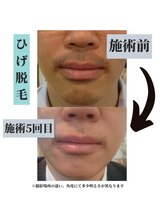 オリオンドットエスツー(Orion.S2)/【Before→After】