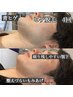メンズ脱毛【チラシ掲載中☆彡】初回ひげ脱毛＆カウンセリング