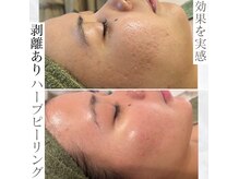 ビューティービューティー(beauty×beauty)