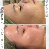 ビューティービューティー(beauty×beauty)