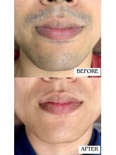 バディーズ(BUDDieS)/20代　