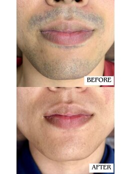 バディーズ(BUDDieS)/20代　