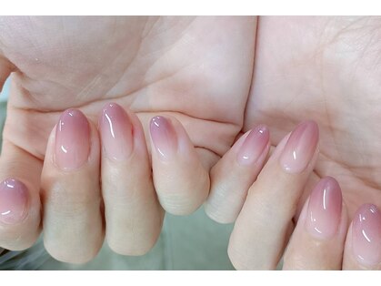 ネイルパキラ(nail pachira)の写真