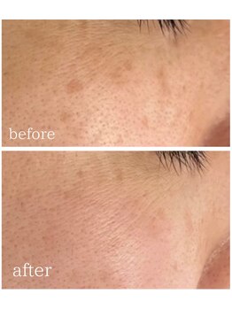 MMK/お肌の土台を整える艶肌ハーブ