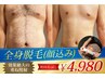 2月末迄！【メンズ脱毛】最短2週間で通える全身脱毛(ニキビケア＆顔込み)