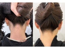 ミース 宮崎店/宮崎市の女性から人気うなじ矯正