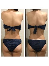 かたぎり接骨院/リリースカッターbefore after