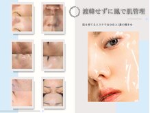 ファゴッド(FaGOD)の雰囲気(韓国最新美容導入で肌質改善へ◎【ピーリング/WAX/よもぎ蒸し】)