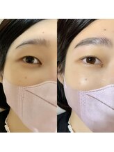 シシ(cici)/ラッシュリフト＋ブロウリフト