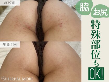 ハーブのほしの写真