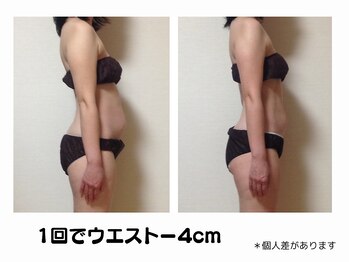 リソウ(Riso)/くびれ美ボディラインが手に入る