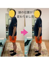 エスコート芦屋サロン/60代　男性　腰痛・肩こり